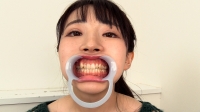 【歯観察】奥歯全部痛くて困ってます...八重歯の可愛い美少女ひかるの歯診断!!