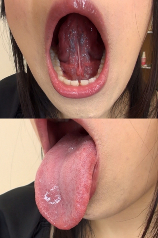 久我かのんちゃんの舌・口内自撮り（通常版＋３Ｄ）