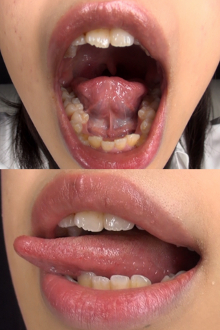 片瀬美咲ちゃんの舌・口内自撮り（通常版＋３Ｄ）