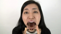 フェチ：誘惑の銀歯、由香里さんの口内