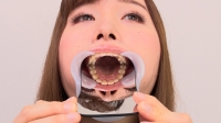 【歯観察】琴菜ちゃん(23)の歯をじっくり観察