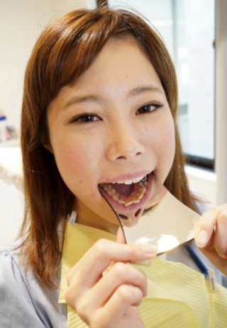 高田明日香(23)【歯科医師治療映像】左上4番5番銀歯治療＆最強縁下歯石除去